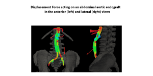 displacement force acting on an abdonminal aortic endografy in the anterior and lateral view